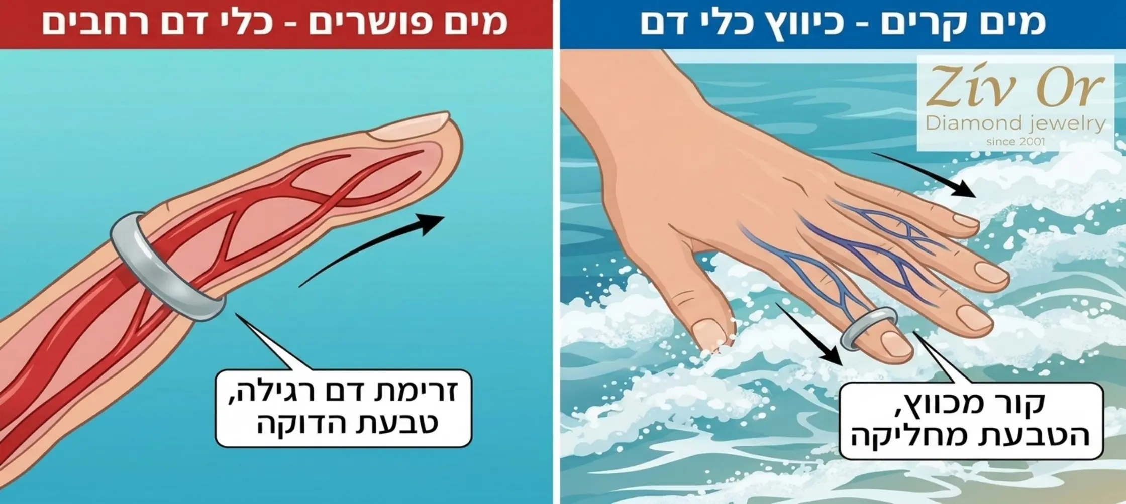 תרשים המדגים כיצד טמפרטורת מים קרה מכווצת את כלי הדם באצבע וגורמת לטבעת להחליק החוצה בקלות אל תוך גלי הים
