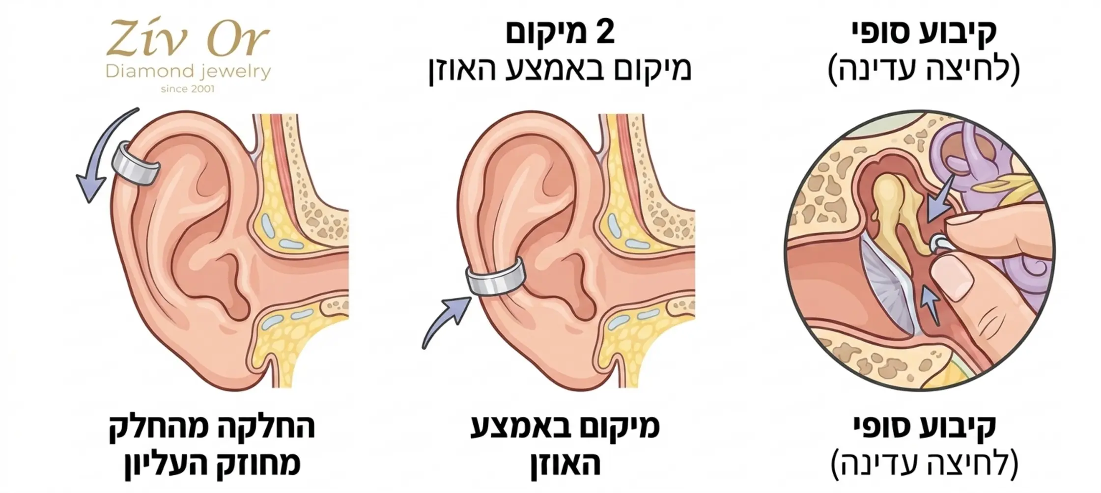 אינפוגרפיקה המציגה את האוזן האנושית בשלושה שלבים ברורים עם חיצים המראים כיצד להחליק את האיר קאף מהחלקה העליון של האוזן ועד לאמצע, כולל תקריב על פעולת הלחיצה העדינה לקיבוע הסופי